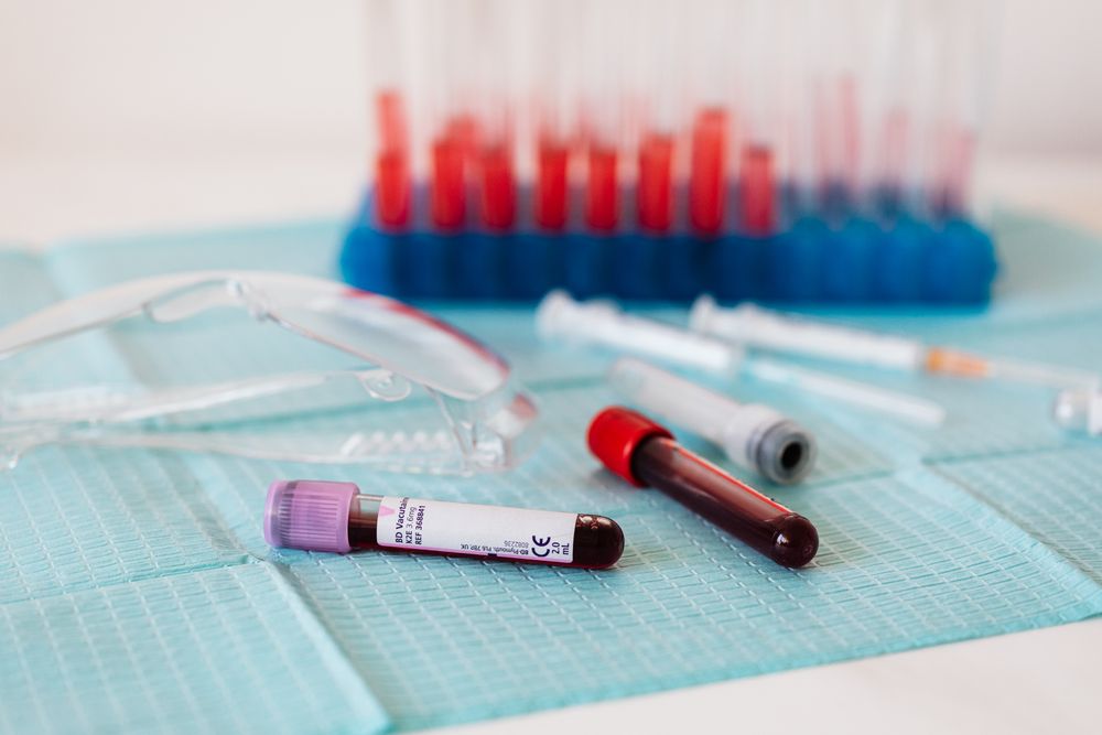 Blood collection tubes arranged on a clinical tray